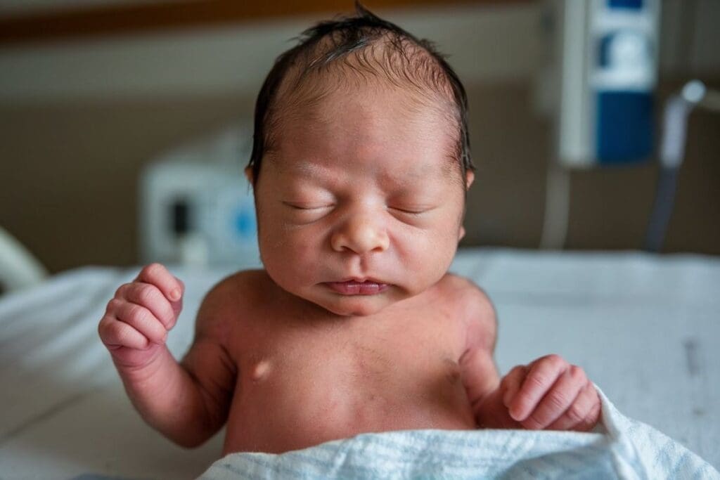 Four Main Causes of Congenital Birth Defects