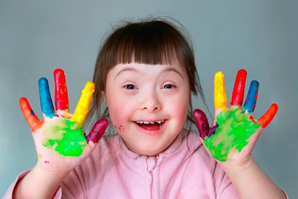 How Common Is Down Syndrome in Mothers?