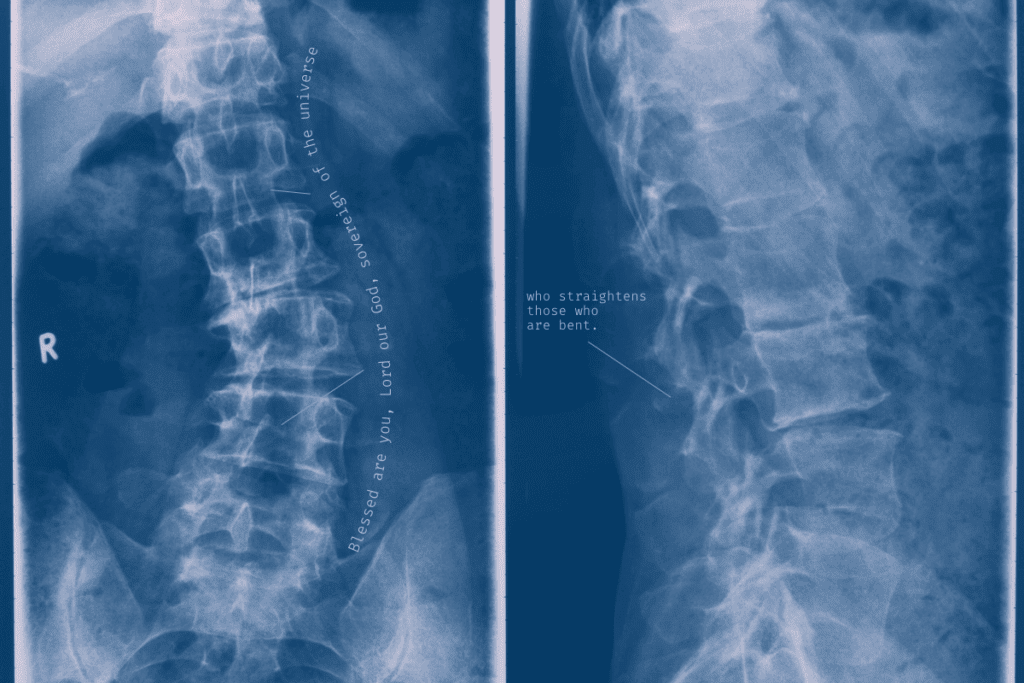 Spinal Cord Anomalies: Three Congenital Ailments Explained