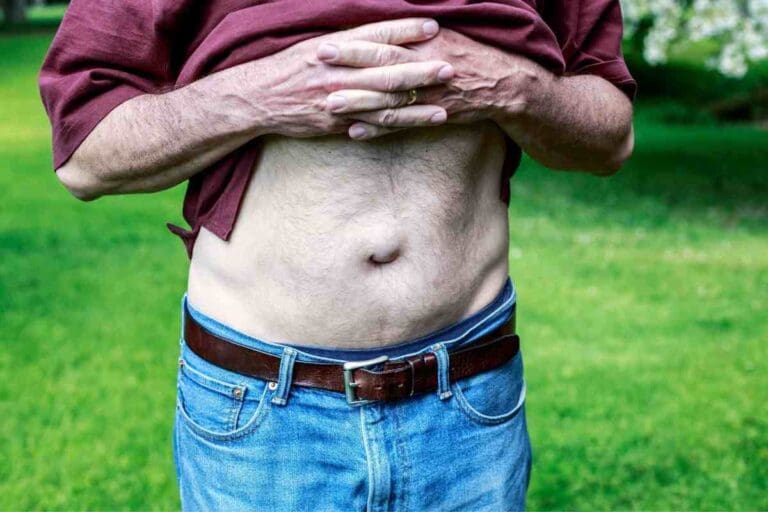 Ultimate 2-Finger Test for Hernia: Powerful Insights for Effective Hiatal Hernia Self-Care