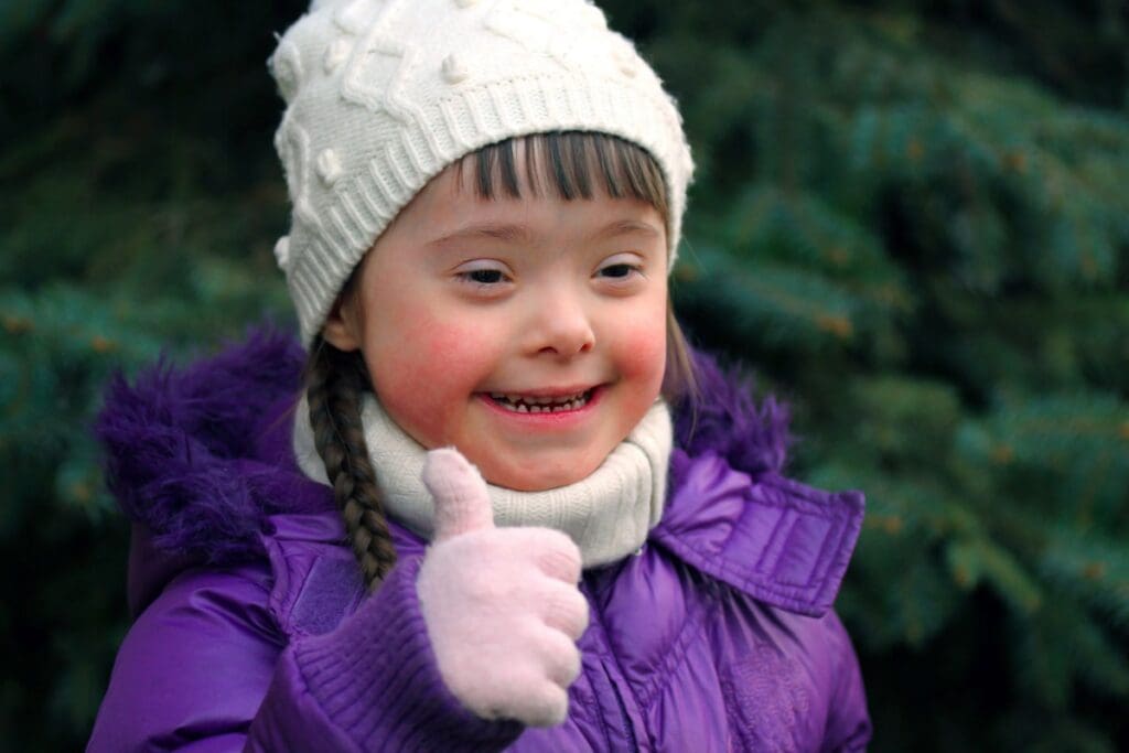 Down Syndrome: A Key Example of a Congenital Anomaly