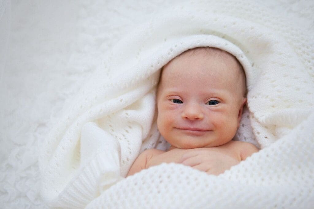 Down Syndrome: A Key Example of a Congenital Anomaly