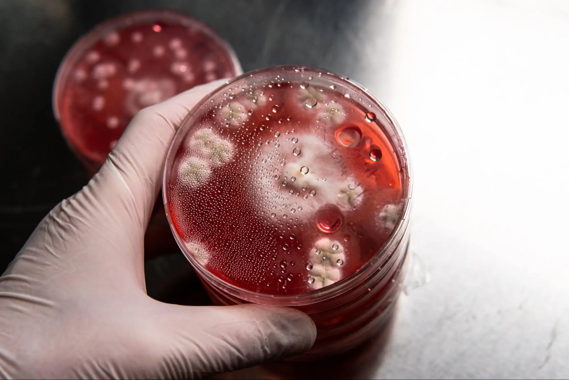 image1 2 LIV Hospital