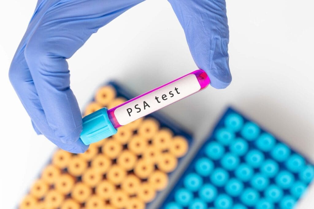 Why PSA Test Not Recommended After 70 | My PSA Is 56