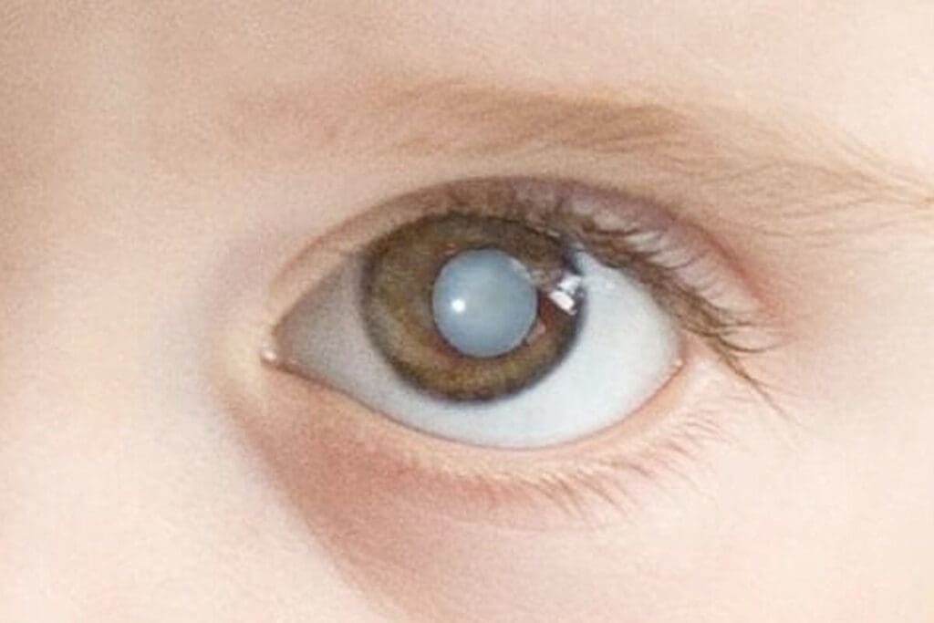 What is a Congenital Anomaly Called? Exploring anomalies