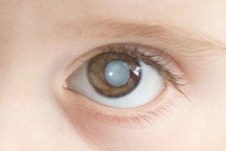 What Is a Congenital Anomaly Called? 7 Powerful Facts About Anomalies