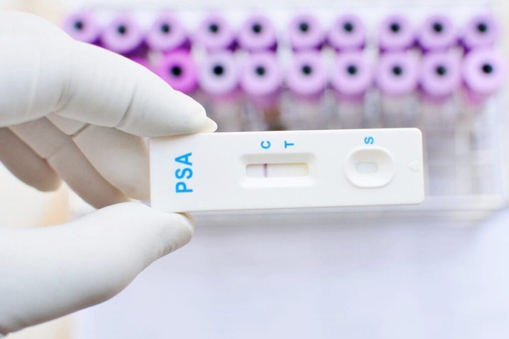 How Much Can PSA Vary Day To Day | Daily PSA Variation