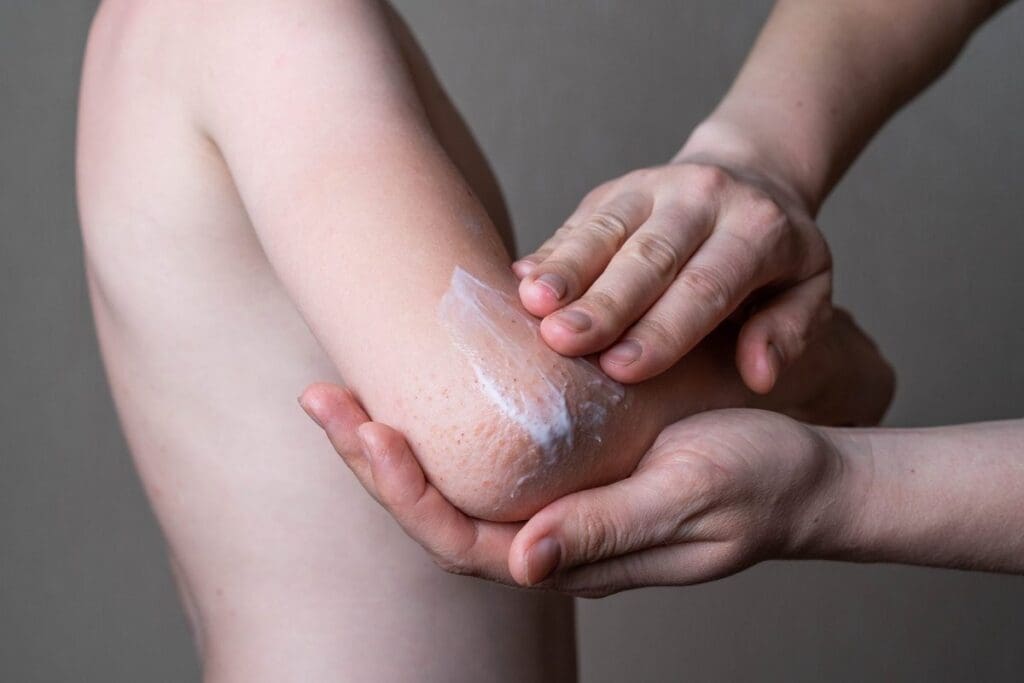 Baby Eczema: 10 Expert-Approved Ways to Protect and Soothe Skin