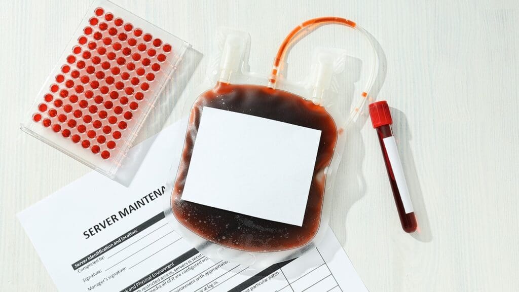 AML prognosis factors