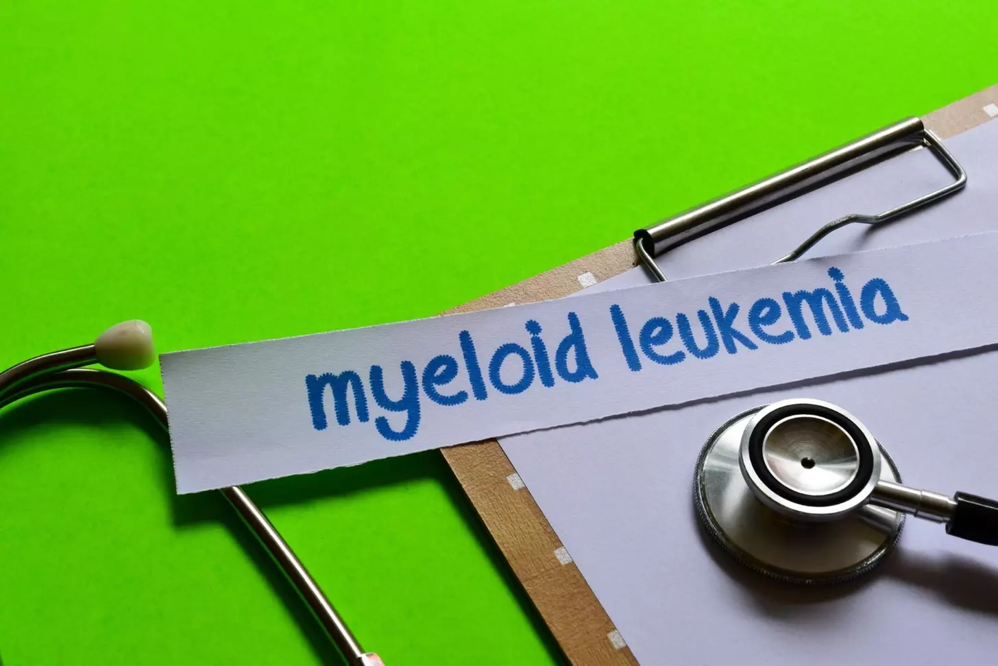 How Fast Does Acute Myeloid Leukaemia (AML) Develop and How Deadly Is It?