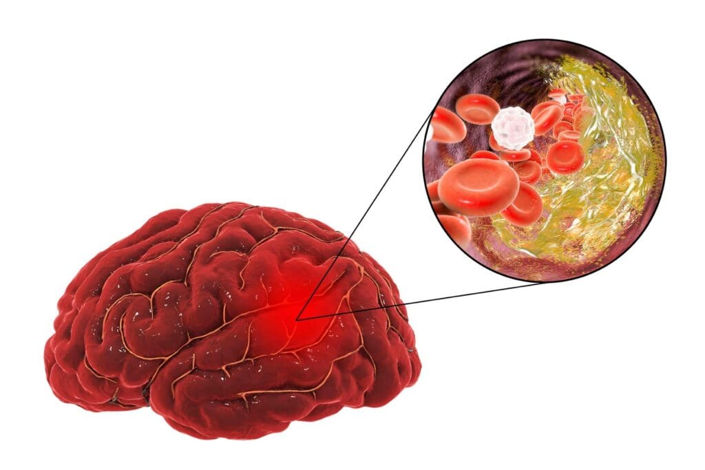 blood-brain barrier