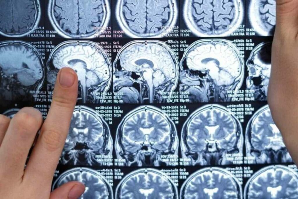 18F FDG: 8 Powerful Facts for Your Ultimate Scan