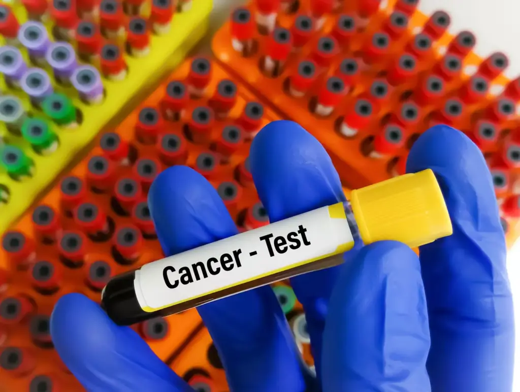 What Is Remission in Cancer What Is Remission in Cancer