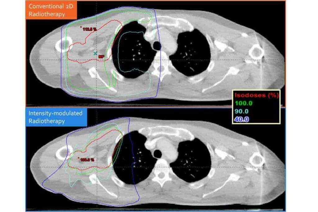 CBCT Radiation Dose Comparison: The Ultimate Guide
