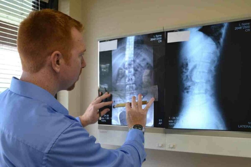 X Rays Cause Cancer? Risk & Safe Exposure Levels