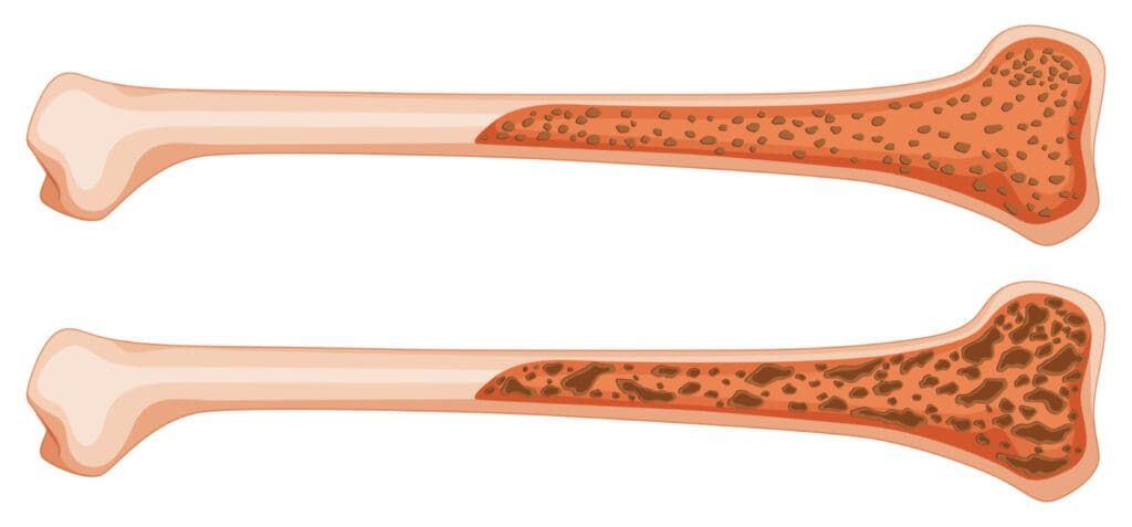 cross-section of a human bone