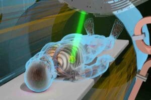 CT Scan Dose of Radiation: The Ultimate Shocking Facts