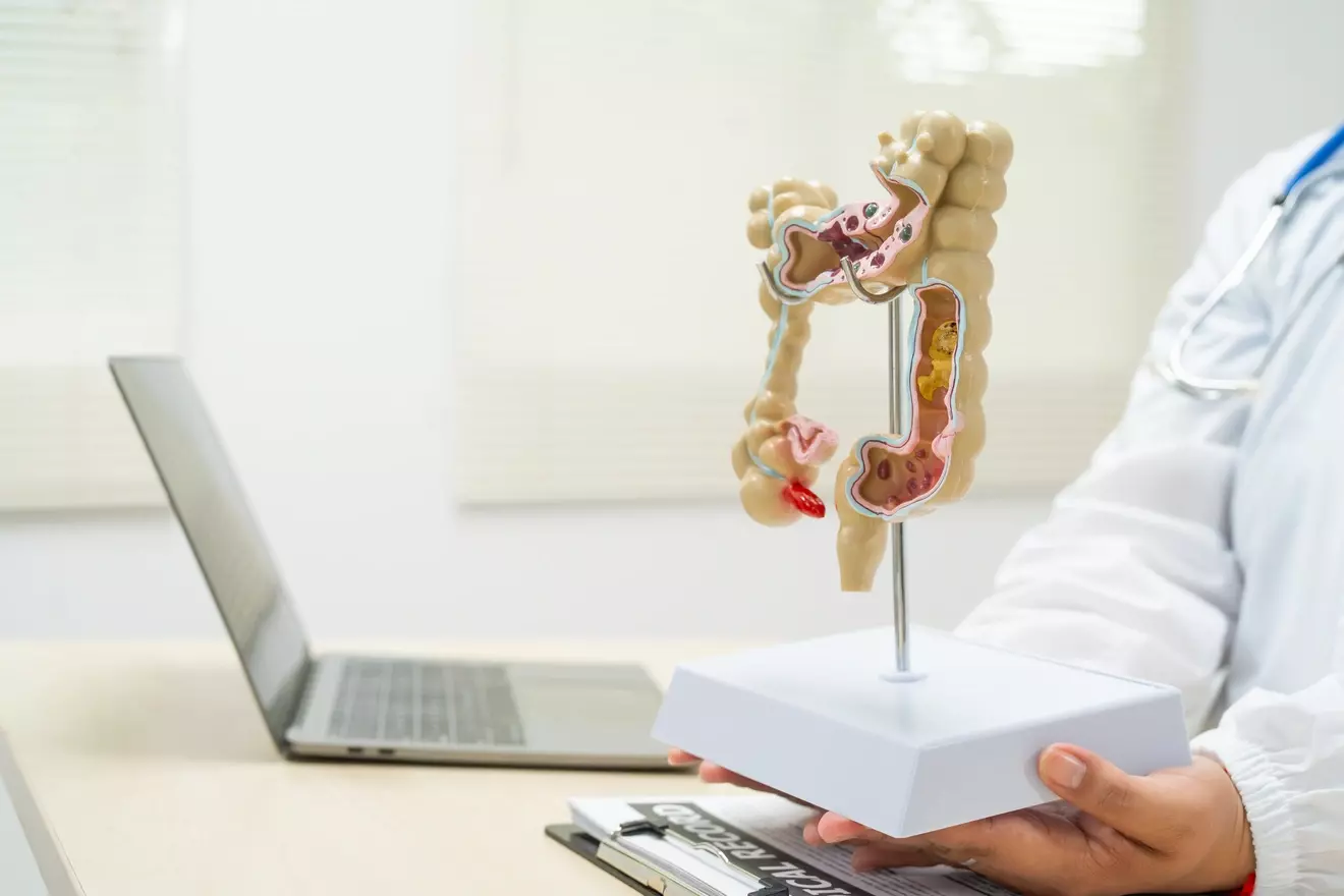 bcg bladder LIV Hospital