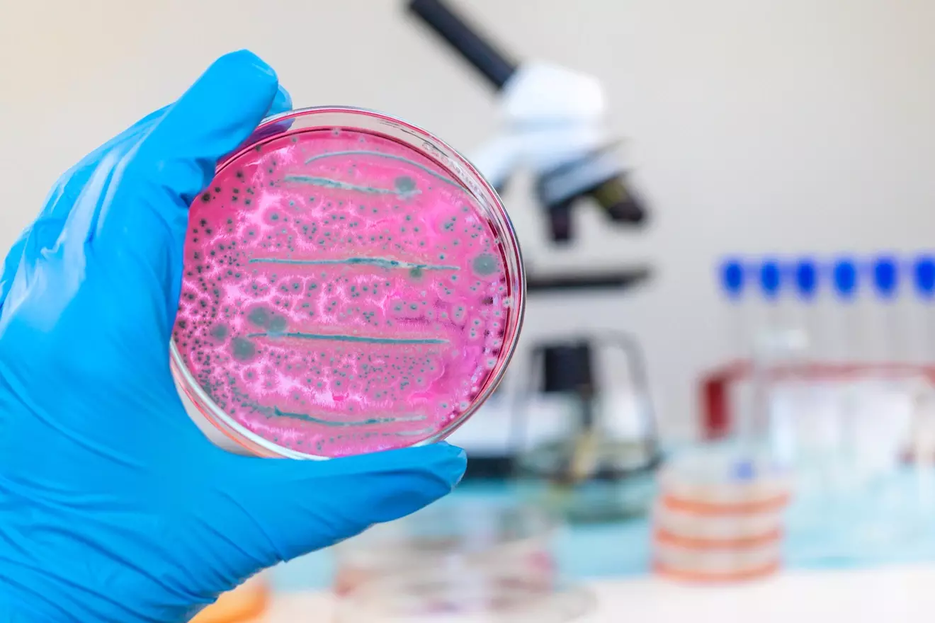 lymphoid cells LIV Hospital