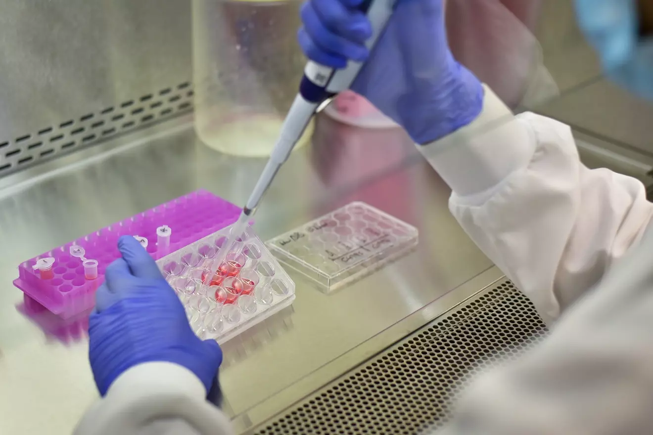 Which Cell Types Produce Antibodies? Compare and Contrast T Cells and B Cells 1 do t cells produce antibodies LIV Hospital