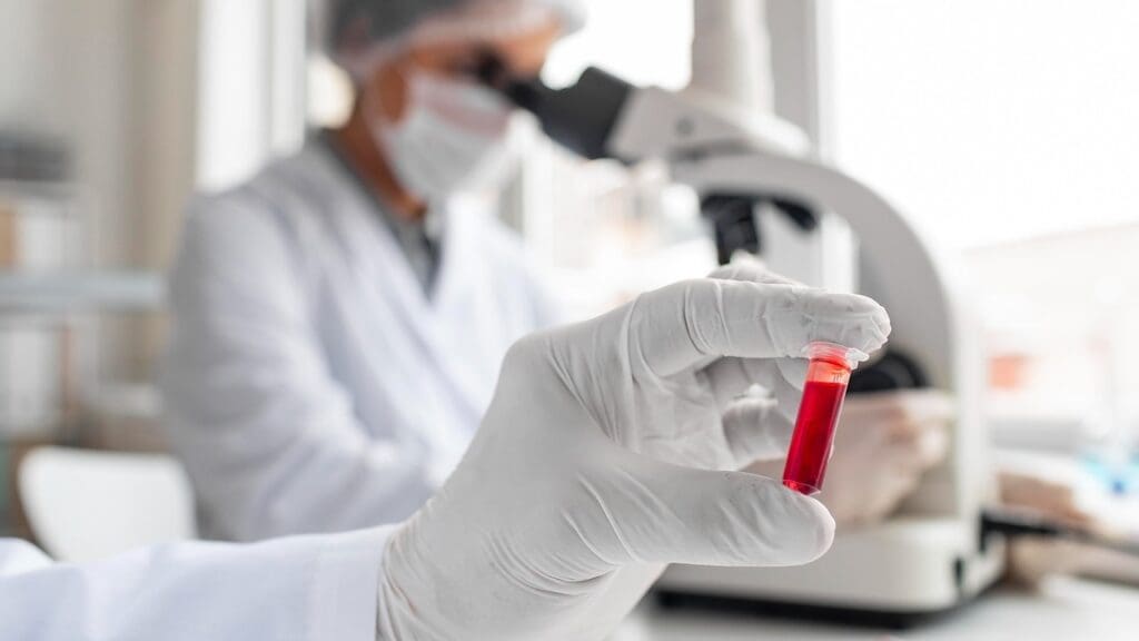 hematopoietic stem cells