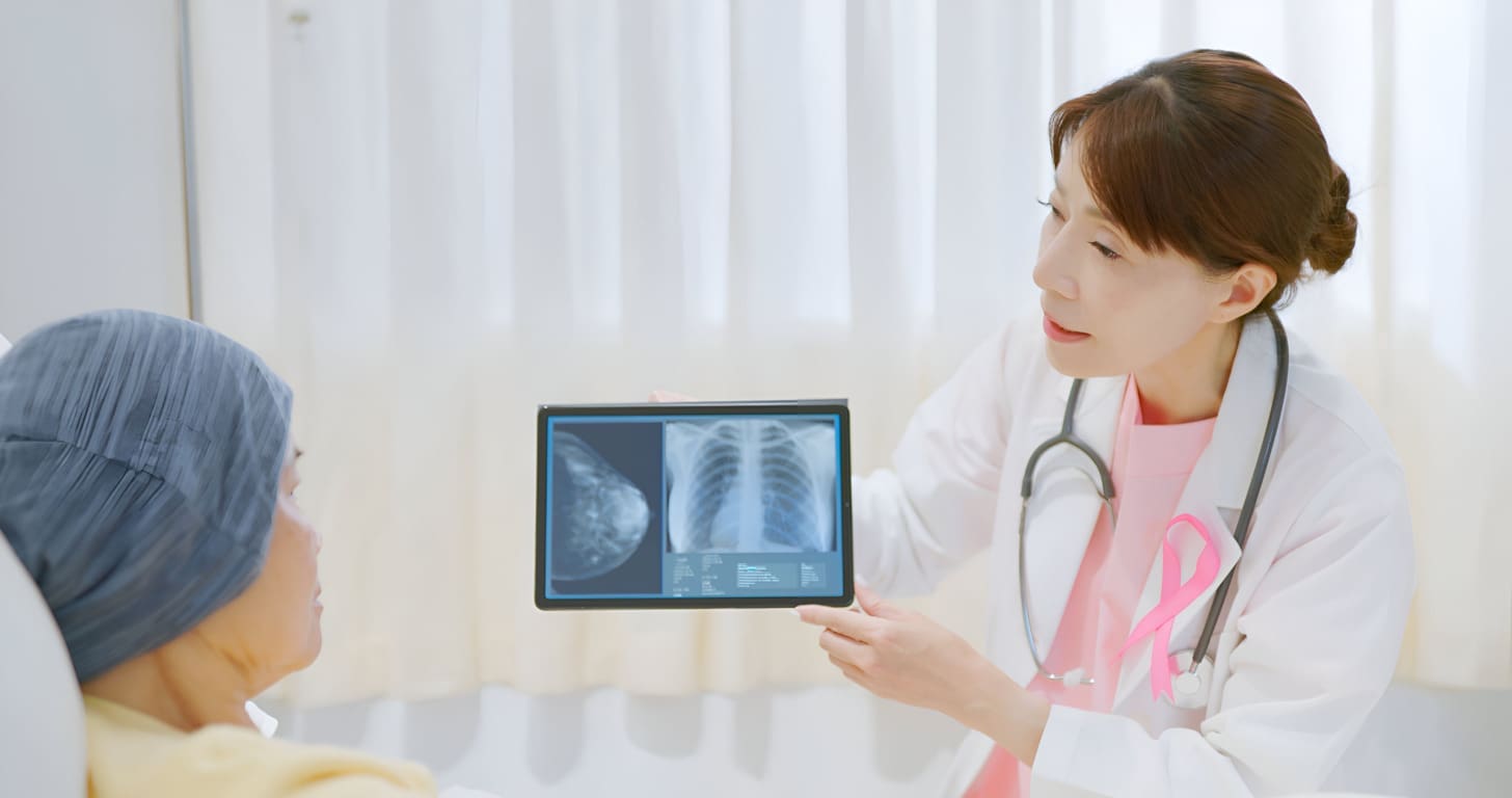 Metastatic Breast Cancer in Bones: 7 Key Facts You Need to Know