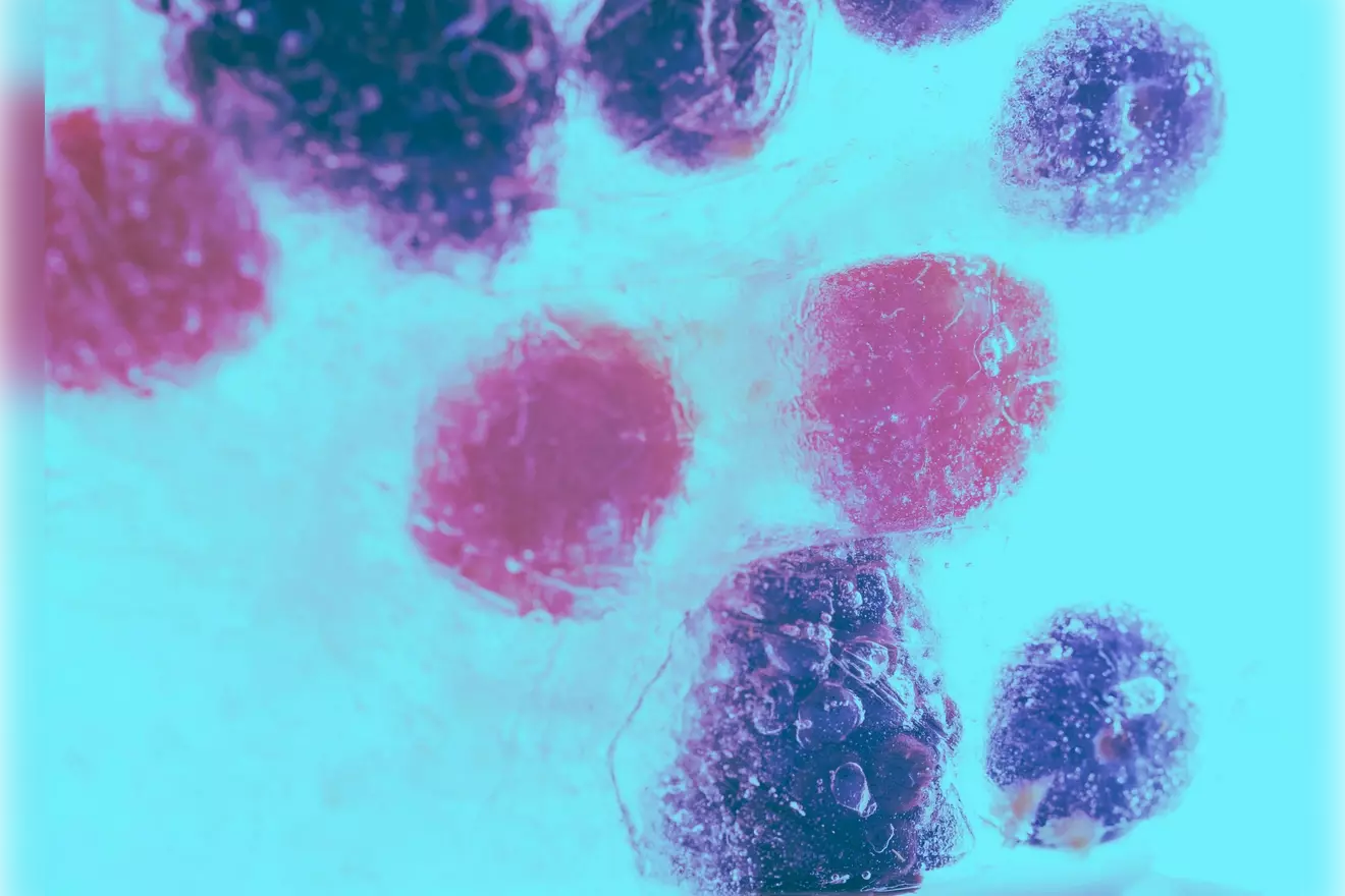 b lymphocytes LIV Hospital