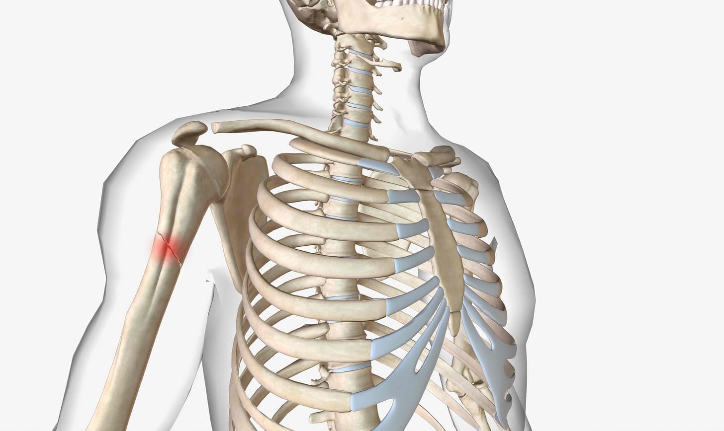 What Is Metastatic Bone Disease and How Are Osteoblastic and Osteolytic Metastases Classified? 1 What Is Metastatic Bone Disease and How Are Osteoblastic and Osteolytic Metastases Classified?