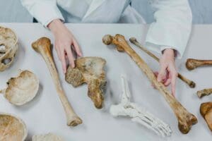 10 Key Facts About Mets to Bone and Lytic Bone Metastases