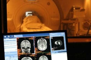 fMRI vs PET: 5 Powerful & Essential Differences