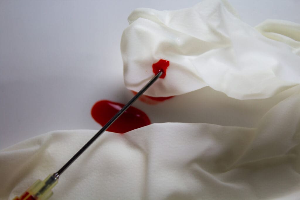 macro image injection needle with 07 mm diameter 1 LIV Hospital