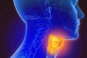 CT Scan Head and Neck Cancer: 7 Crucial Diagnostic Insights