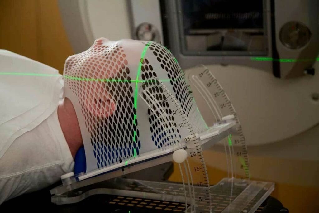 Radiation Treatment vs Chemo: 7 Key Differences