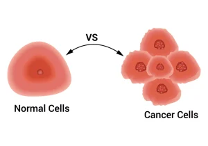 What Are Benign Tumors and How Do They Differ from Cancer?
