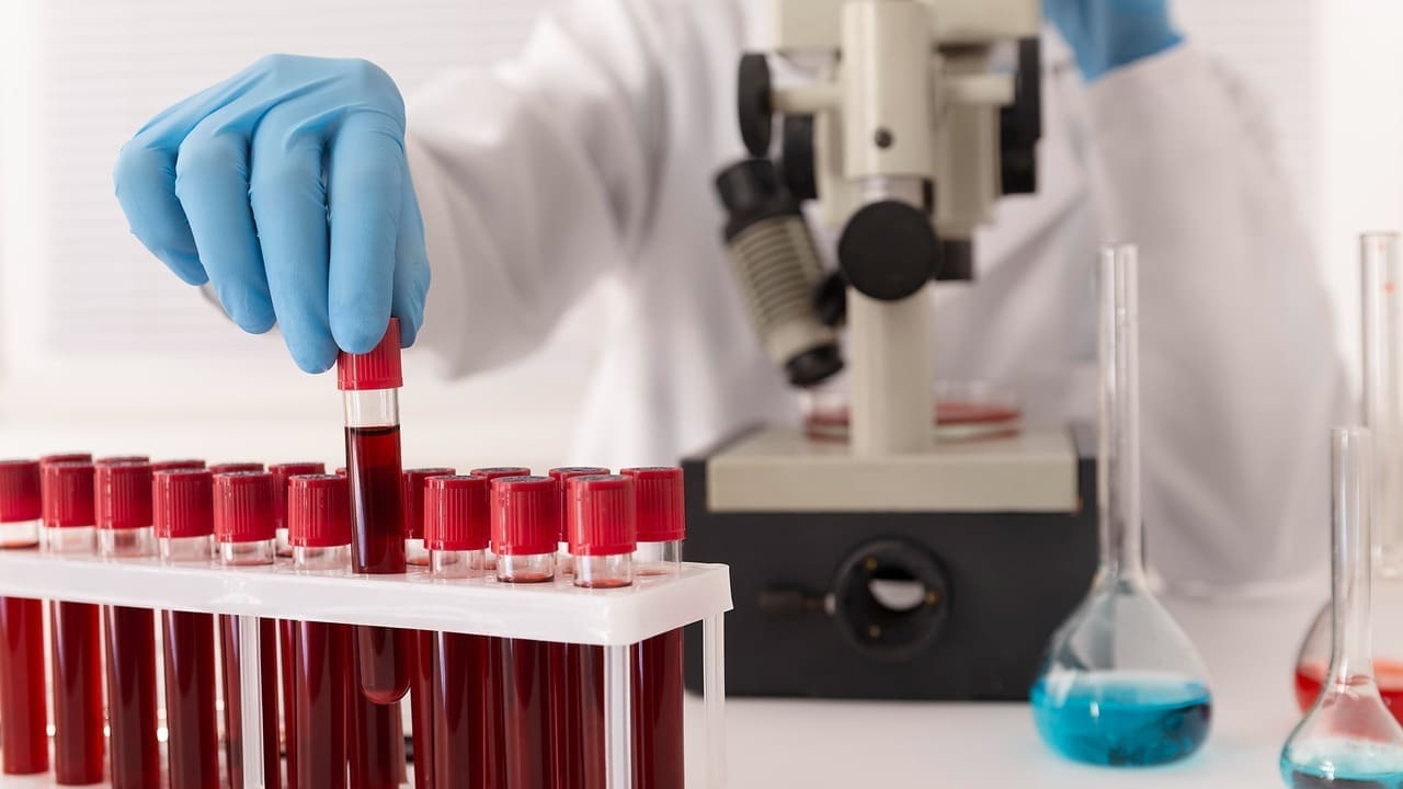 What Is Cord Blood Testing and How Is Umbilical Cord Blood Collected in Newborns?