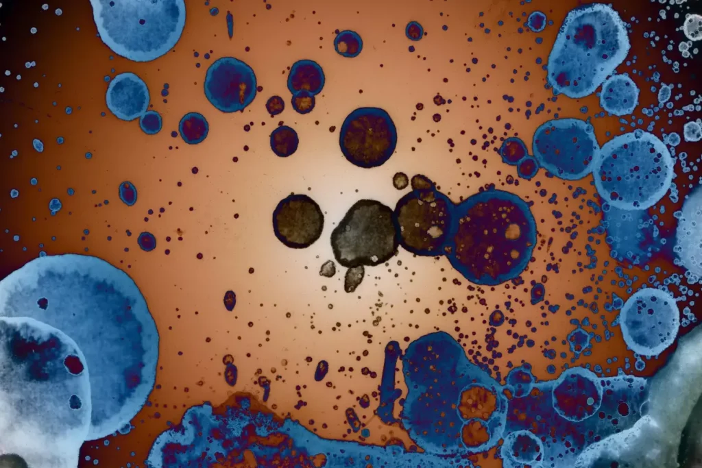 A vibrant and detailed cross-section of a benign tumor, captured through a high-resolution medical imaging lens. The tumor appears as a distinct, well-defined mass with a smooth, rounded outline, nestled amidst the surrounding healthy tissue. The interior structure displays a uniform, homogeneous texture, devoid of the irregular patterns and necrotic regions characteristic of malignant growths. Warm, golden lighting casts a gentle glow, highlighting the tumor's benign nature and lack of aggressive features. The overall scene conveys a sense of clinical precision and scientific observation, inviting the viewer to explore the nuanced differences between benign and malignant tumor characteristics.