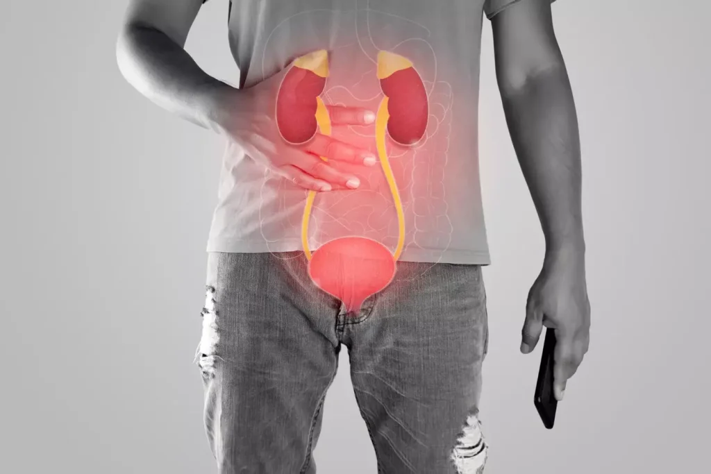 Image illustraing patient with adbdominal pain, urinary system highlighted