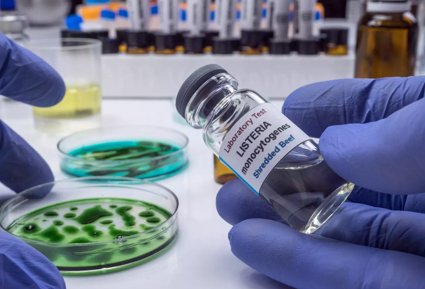 21 FDA Approved Gene Therapy Products and Cell Therapies: Complete List (2025) 1 gene therapy products LIV Hospital