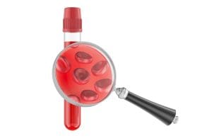 What Does Hematopoietic Mean and Where Are Hematopoietic Stem Cells Found?