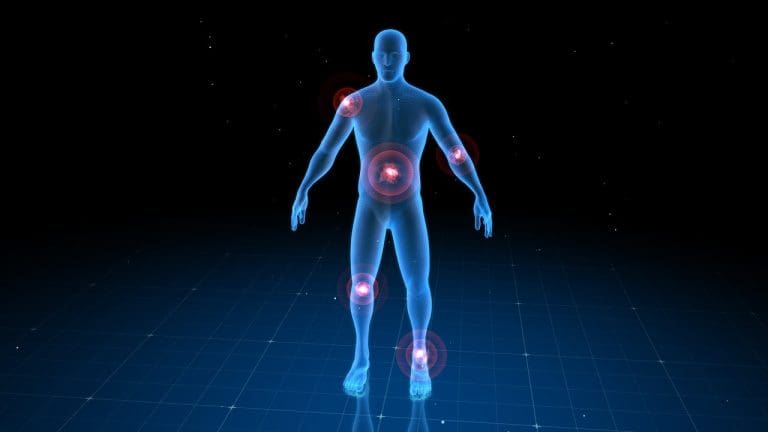 Graft Versus Host Disease Symptoms