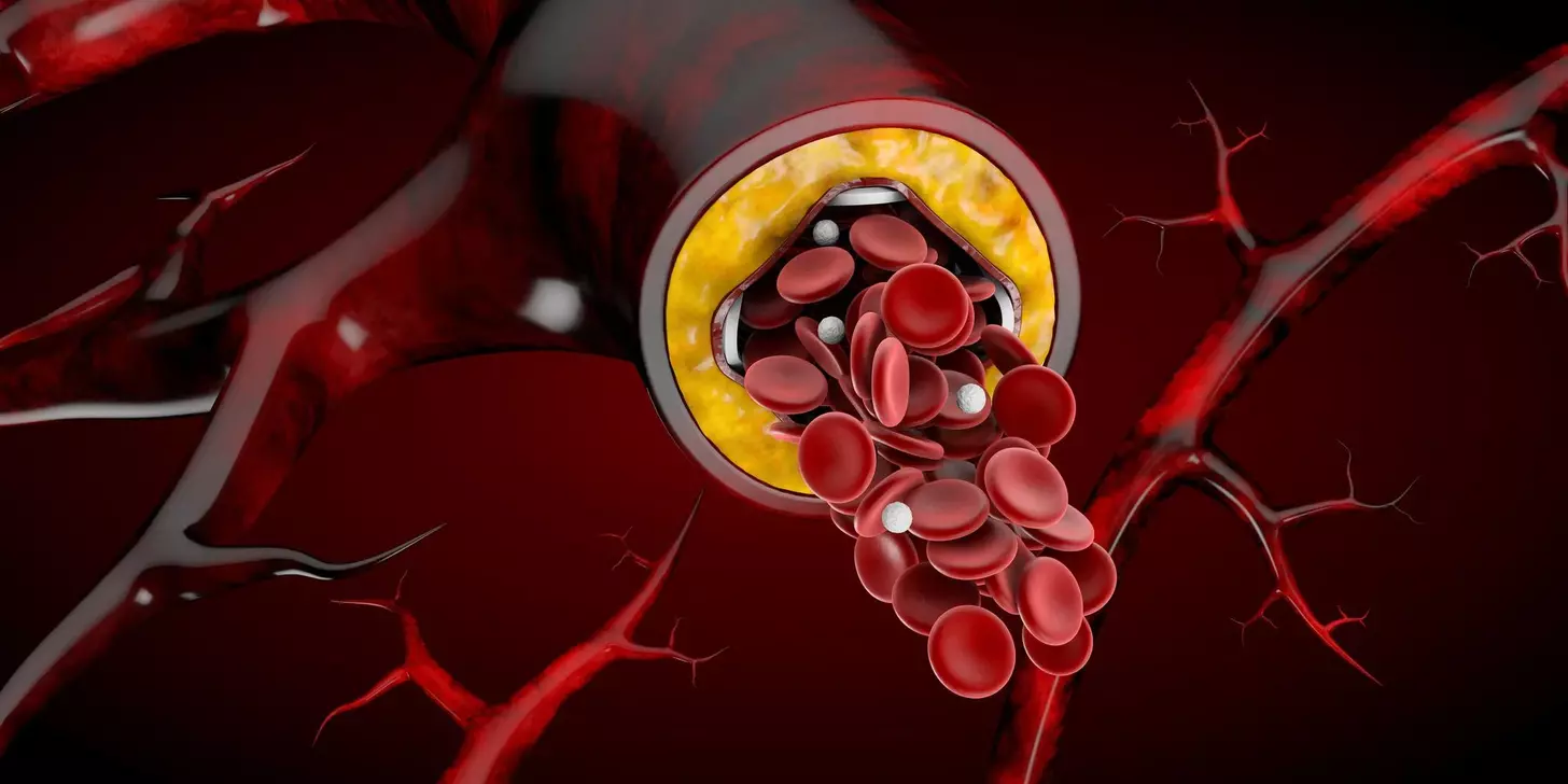 What Happens When Bone Marrow Enters the Bloodstream? Causes, Symptoms, and Risks 1 What Happens When Bone Marrow Enters the Bloodstream? Causes, Symptoms, and Risks