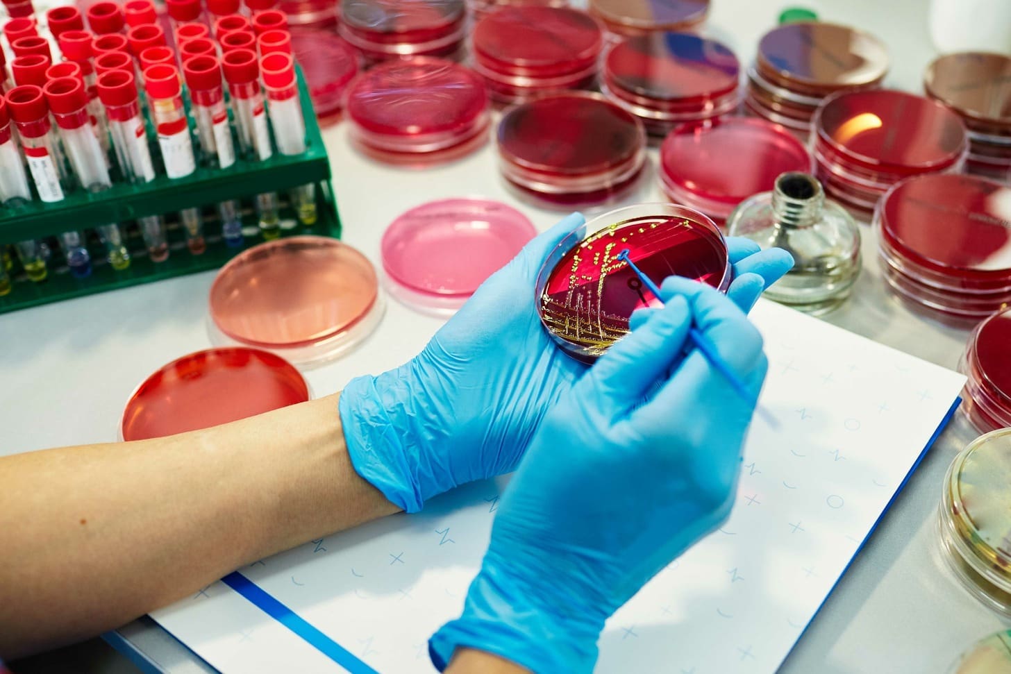 7 Key Differences Between Cord Blood and Cord Tissue Banking