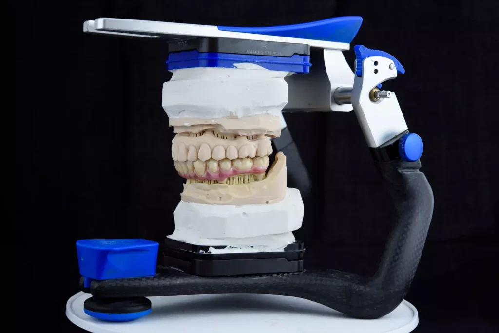 A detailed medical diagram illustrating the key classifications of dental implant bone density and quality. A clean, technical rendering with precise anatomical accuracy, lit by bright, natural light from an overhead angle. The foreground depicts the four main bone types - Type I, II, III, and IV - in cross-section, with clear labels and explanatory details. The middle ground shows an overview of the jawbone structure, highlighting the differences in bone density. The background is a neutral, subtly textured surface providing context without distractions. A detailed medical diagram illustrating the key classifications of dental implant bone density and quality. A clean, technical rendering with precise anatomical accuracy, lit by bright, natural light from an overhead angle. The foreground depicts the four main bone types - Type I, II, III, and IV - in cross-section, with clear labels and explanatory details. The middle ground shows an overview of the jawbone structure, highlighting the differences in bone density. The background is a neutral, subtly textured surface providing context without distractions.