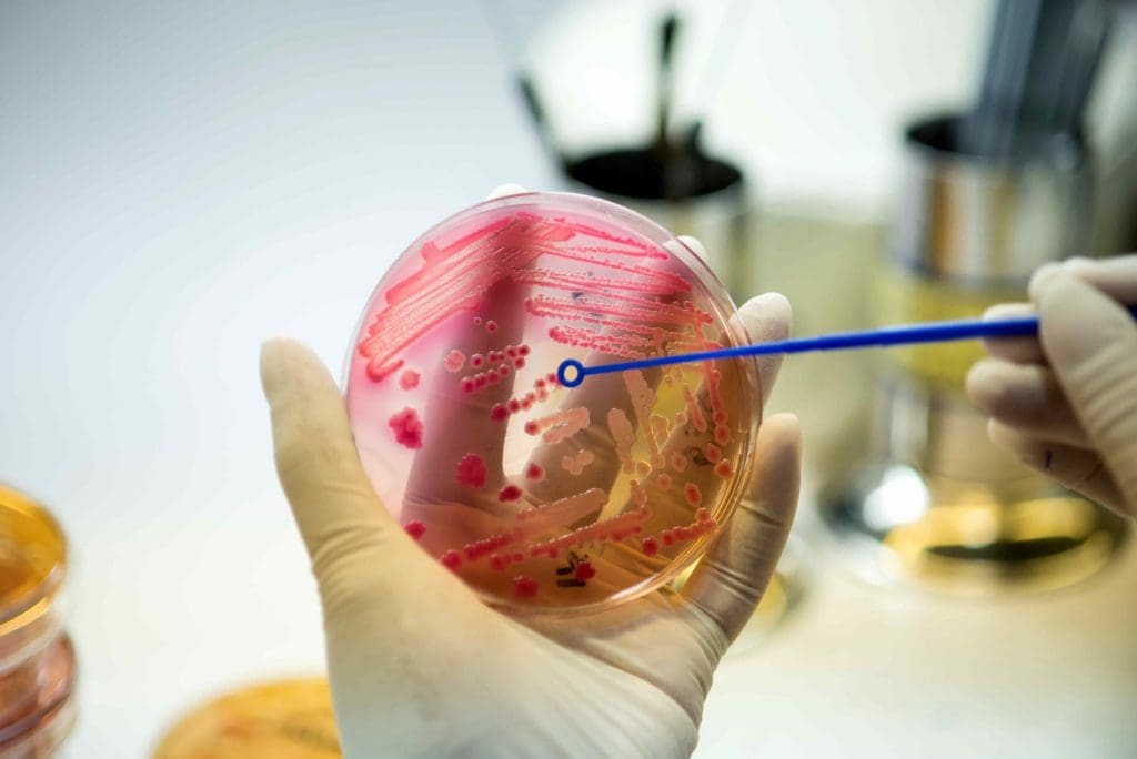 stem cells and diabetes