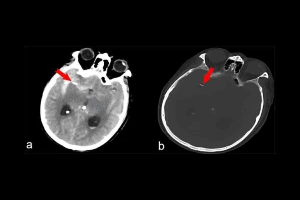 FDG PET: The Ultimate Guide to This Amazing Scan