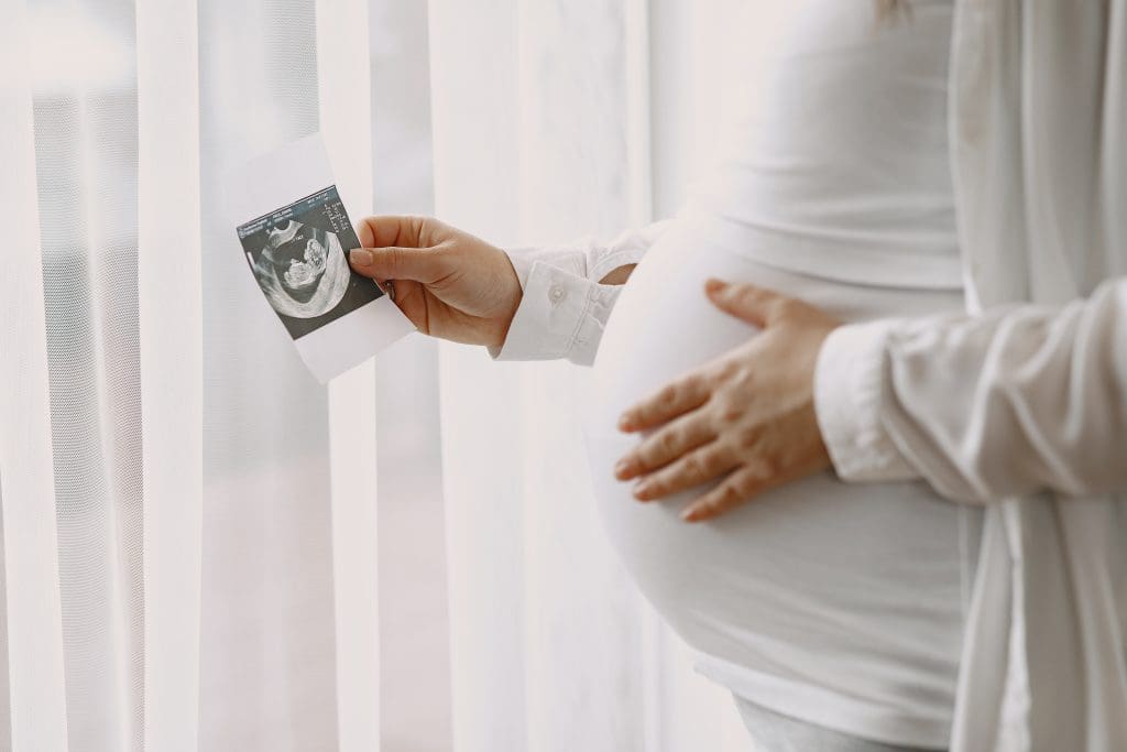 pregnant woman standing by window looking photo LIV Hospital