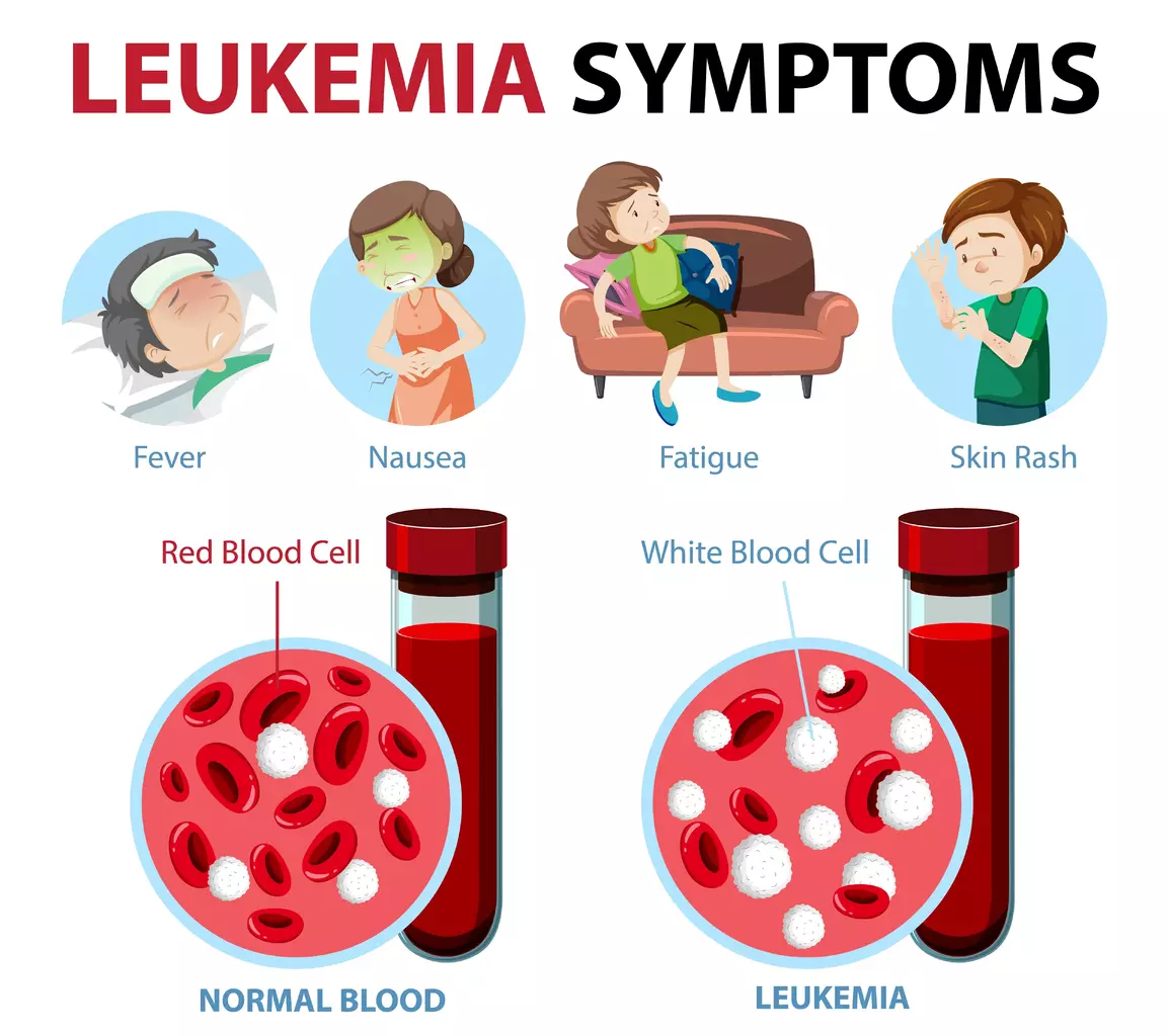 Teenage Leukaemia Symptoms: 10 Key Signs Every Parent Should Know