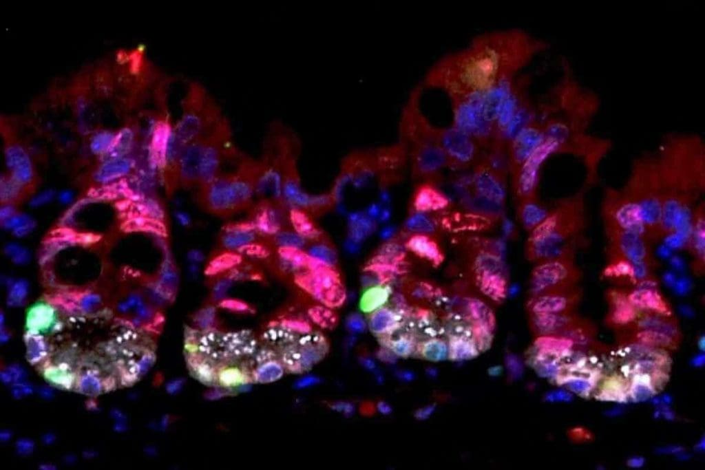 What Does Radiation Do to Cells? Damage Explained