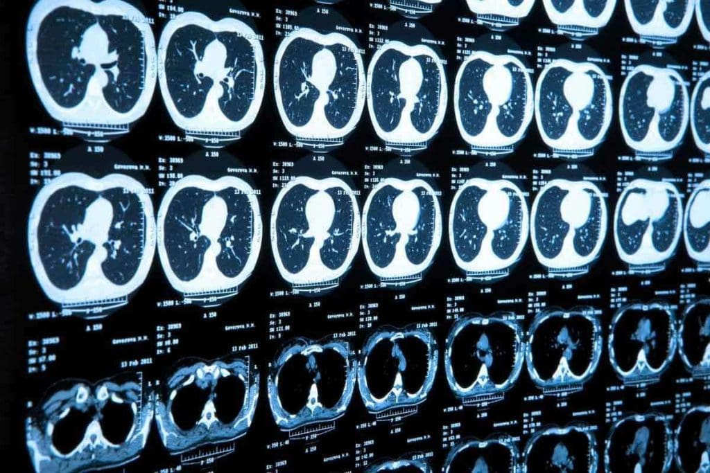 PET CT vs MRI: 8 Key Differences & Benefits