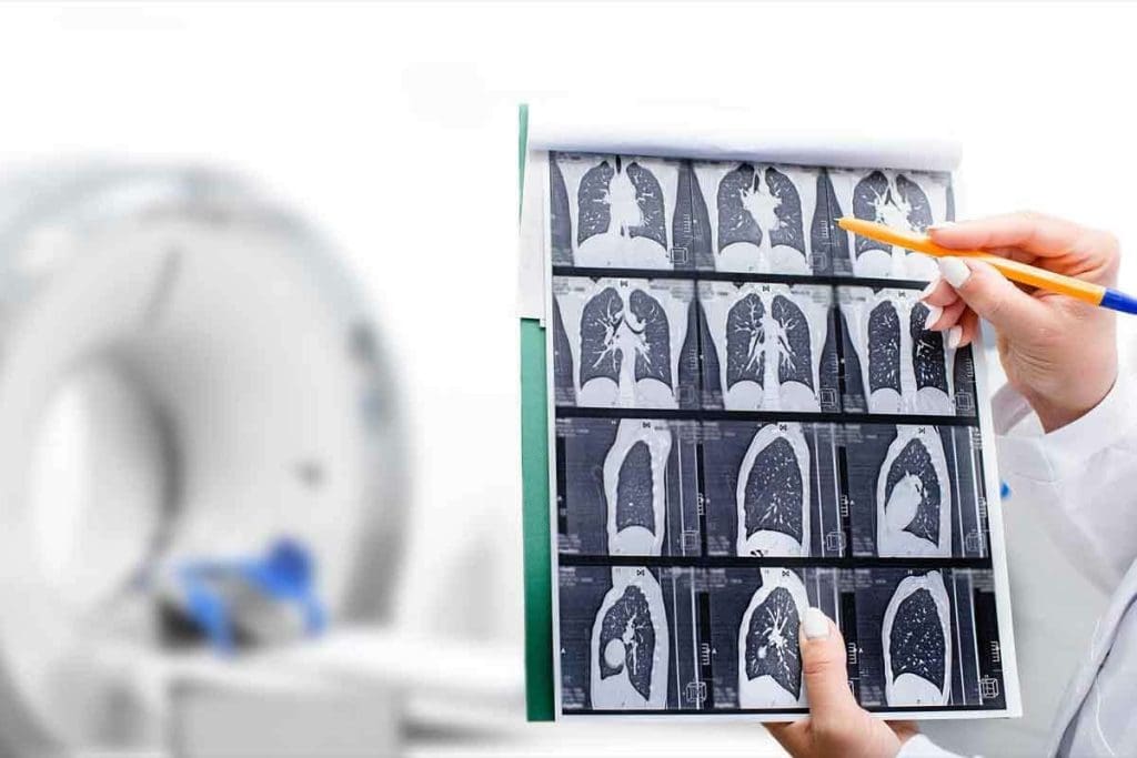 PET CT Versus CT Scan for Cancer Explained